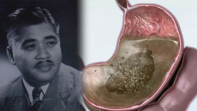 味精没有那么可怕,味精的真相