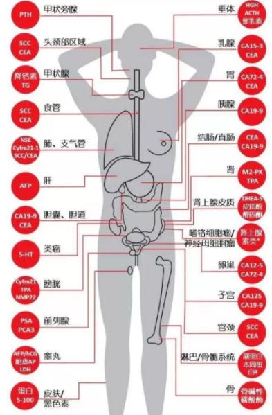 大爷经常咳嗽一查竟是肺癌晚期,大爷咳嗽竟被阿姨说是肺癌