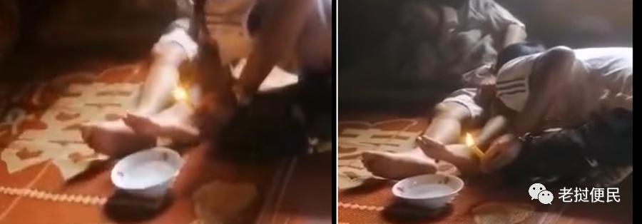 亲大腿点蜡烛,老挝一地区的祛病驱邪方式引争议