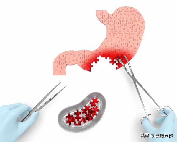 胃穿孔手术中需要做什么操作,胃穿孔手术十几年了需要注意什么