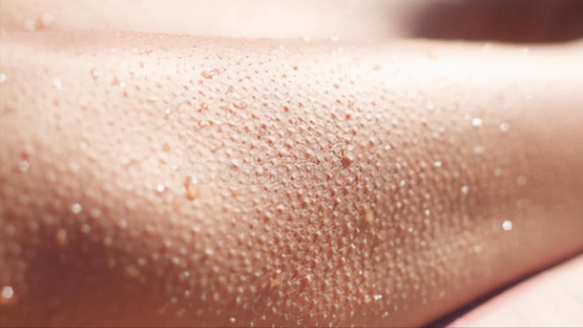 乳腺癌患者手术后，出现上肢水肿，是癌细胞扩散？听听医生怎么说