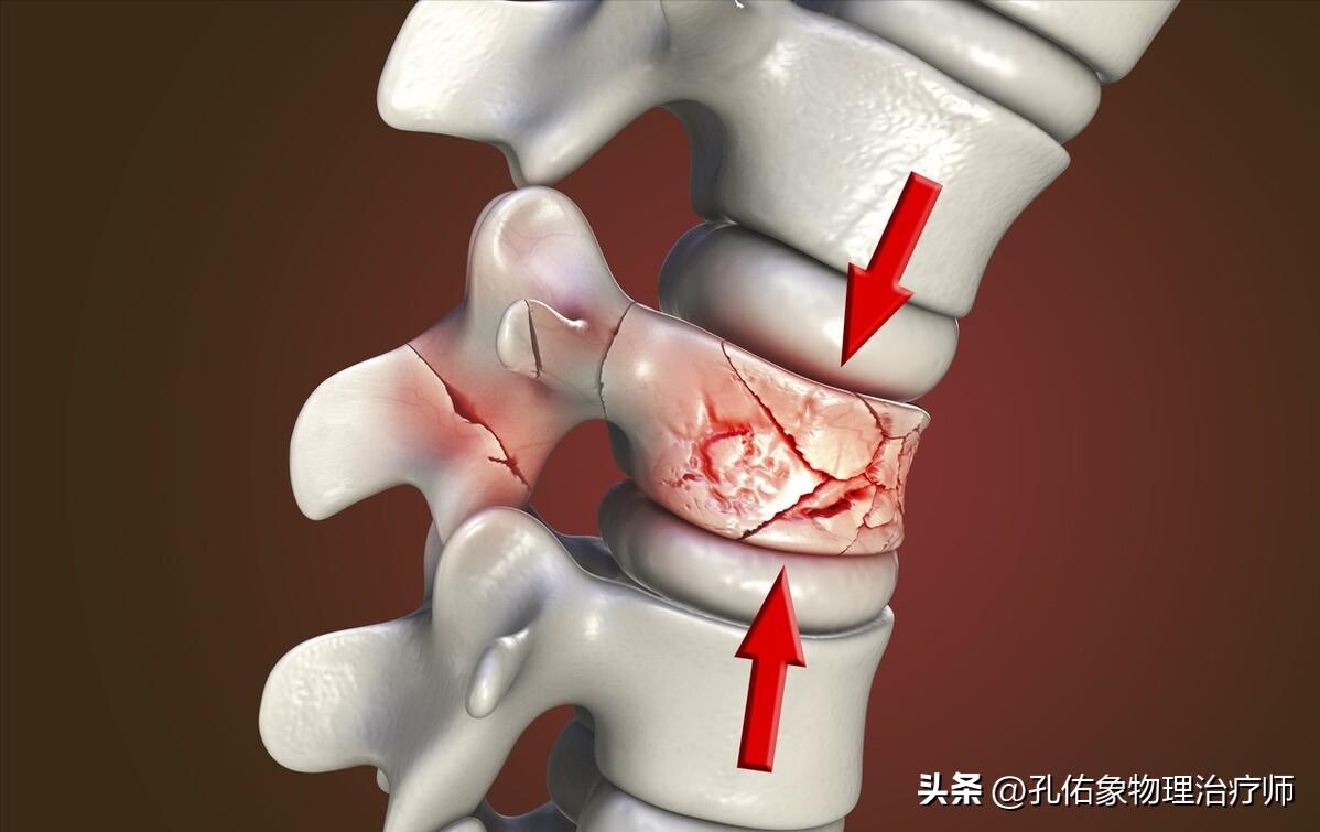 老年人压缩骨折能治好吗,腰椎压缩骨折腰部酸痛怎么办