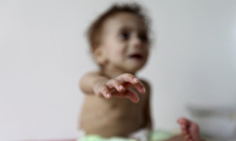 低钙血症的症状和危害,低钙血症的症状及危害