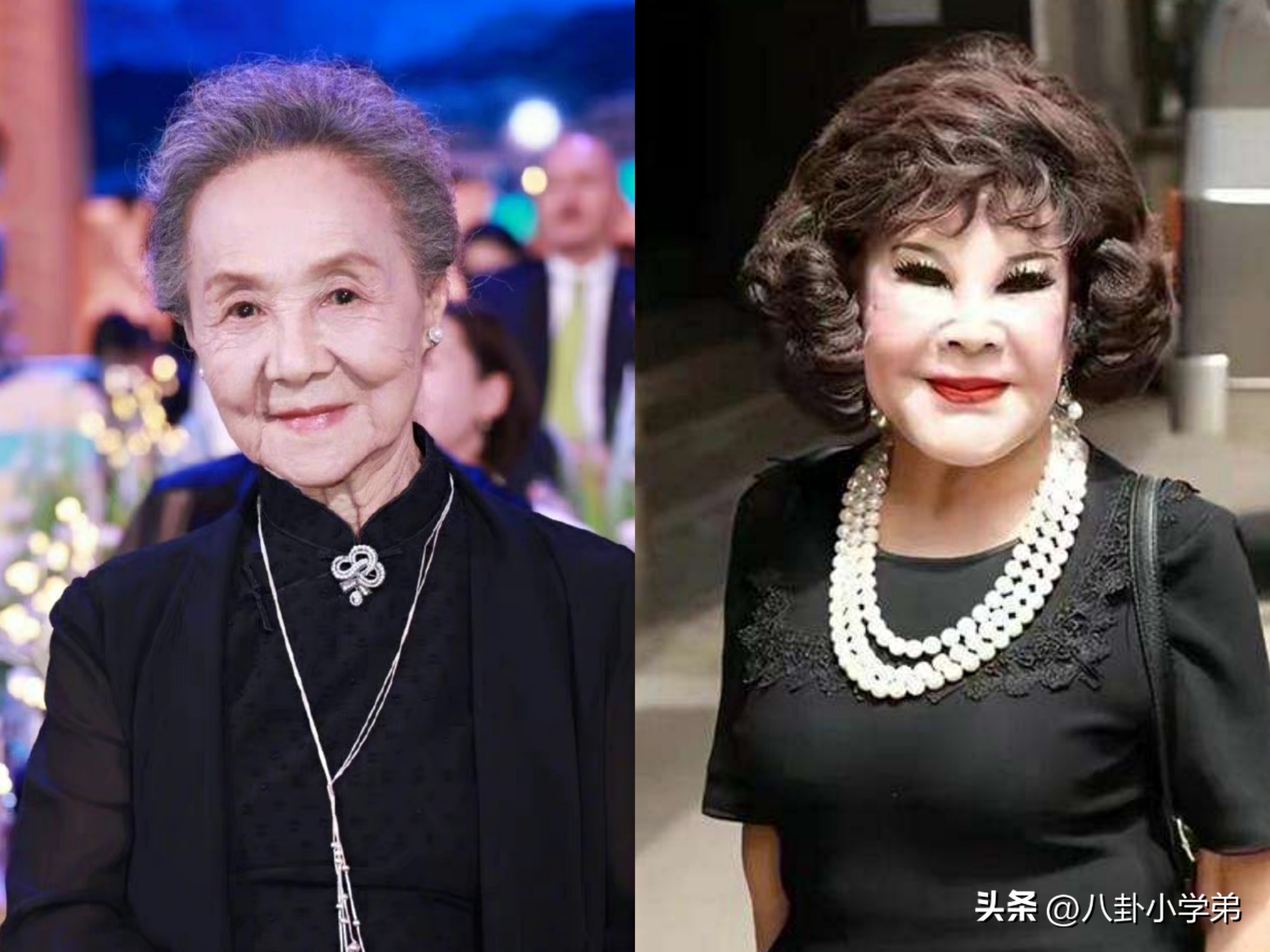 整形脸和真正的美人区别,整形变美的对比图片