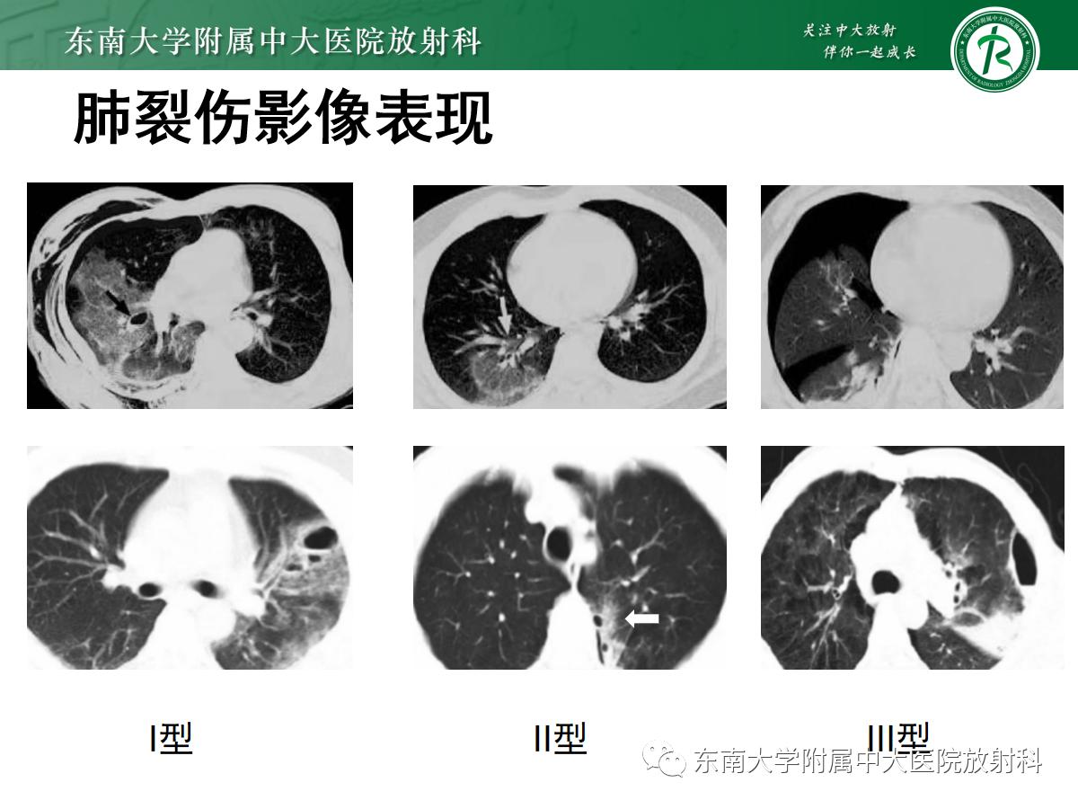 好文分享最新,好文分享重磅完整版