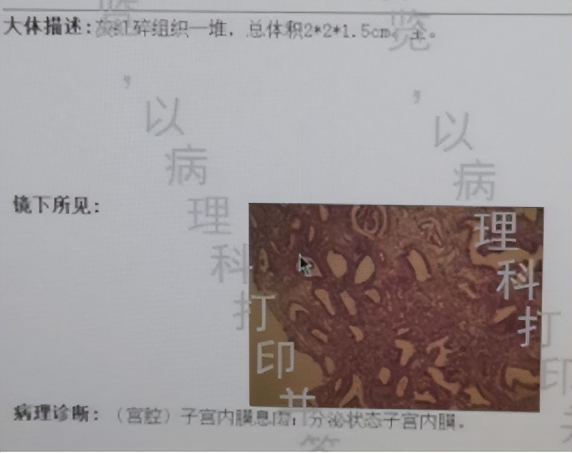 阴道流血不等于月经！异常出血去医院，千万别不当回事