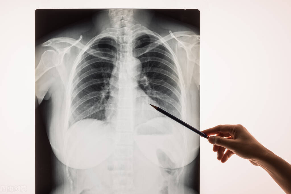 老年人肺炎为何越治越严重,老年人得了肺炎能治好吗