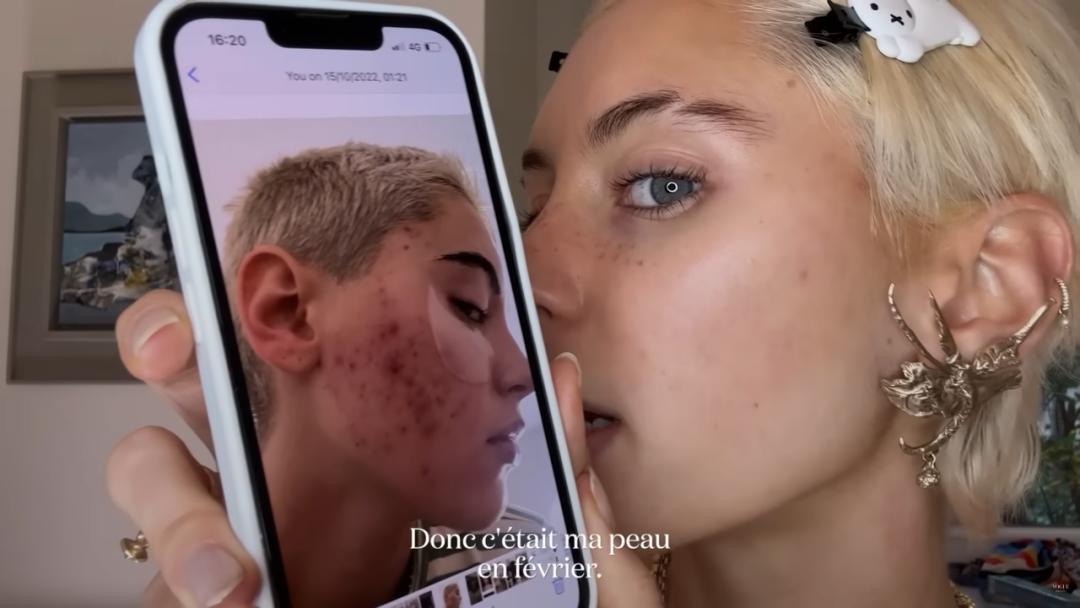 IrisLaw透露自己曾经是油痘肌，靠护肤变美！