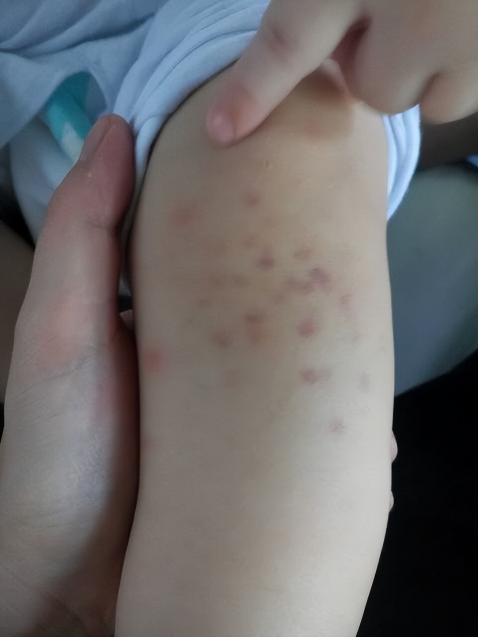 血小板只有9,血小板只有4能恢复正常吗