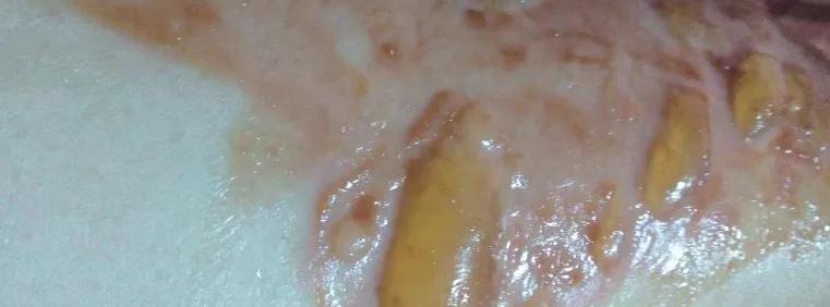 为洗纹身买单,洗纹身有什么代价