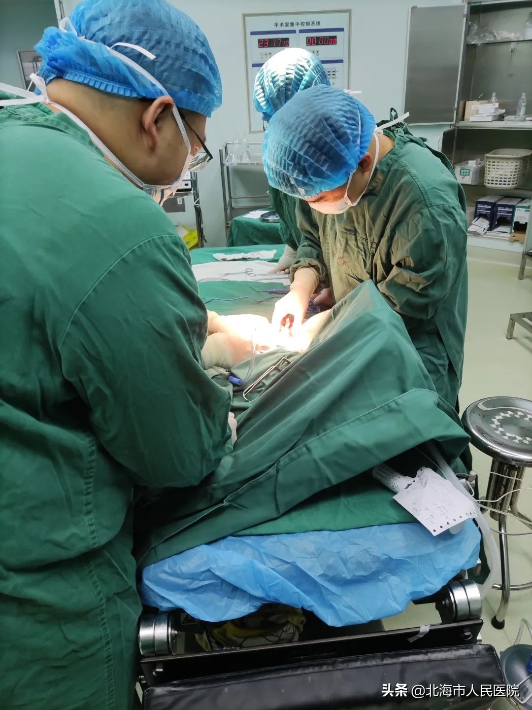 北海一6个月女婴抽搐、发热住院，竟然发现是肠套叠