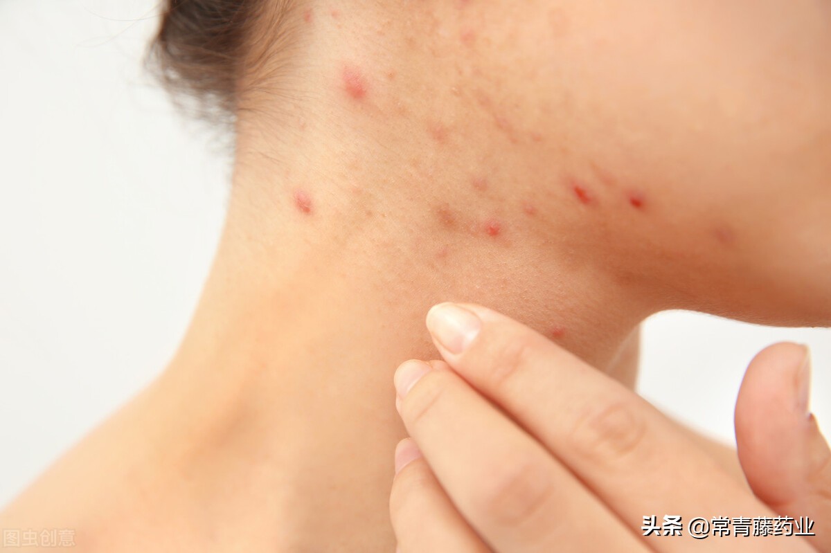 脸颊肿了一个包硬硬的怎么处理,脸颊长个包硬硬的凸起