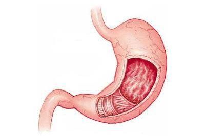 体检查出这9种病大多不用治,一次体检查出26种病这可咋办