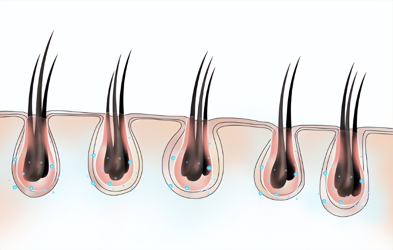 私密部位的毛，究竟能不能脱，怎么脱，这3种情况下，建议剪掉