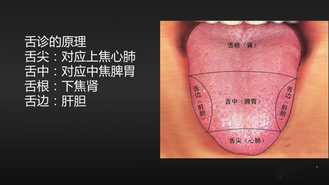 中医四诊中的正常舌象,中医看舌象准还是摸脉准