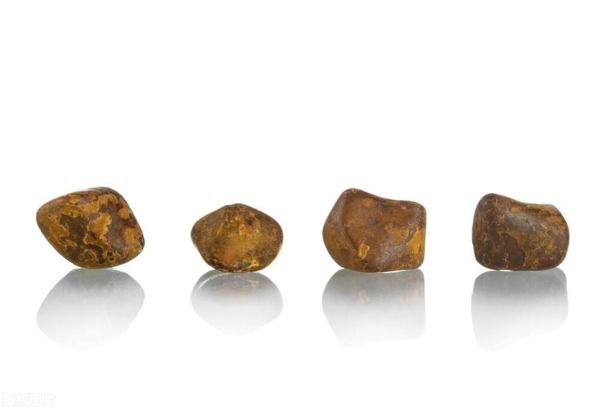 女友出去玩就要上厕所，一次十几分钟，肚子疼有坠胀感，怎么回事