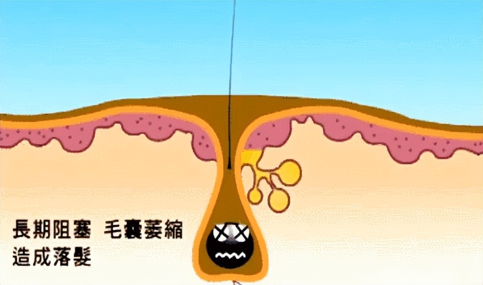 什么洗发水好用不油腻不脱发留香,不同发质洗发水推荐男生