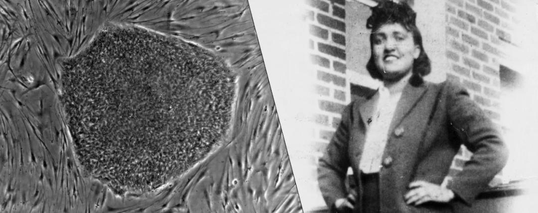 身上的肉价值30亿美元却被医生偷偷卖掉，为何法院还判医生无罪？