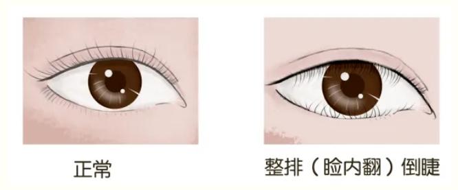 南石医院眼科位置,南石医院眼科怎么样