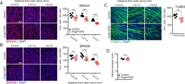 青光眼逆转,治疗青光眼临床新突破