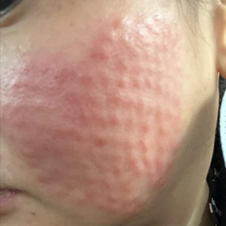 头屑多脱发怎么去除小妙招,头屑如何调理生发最有效