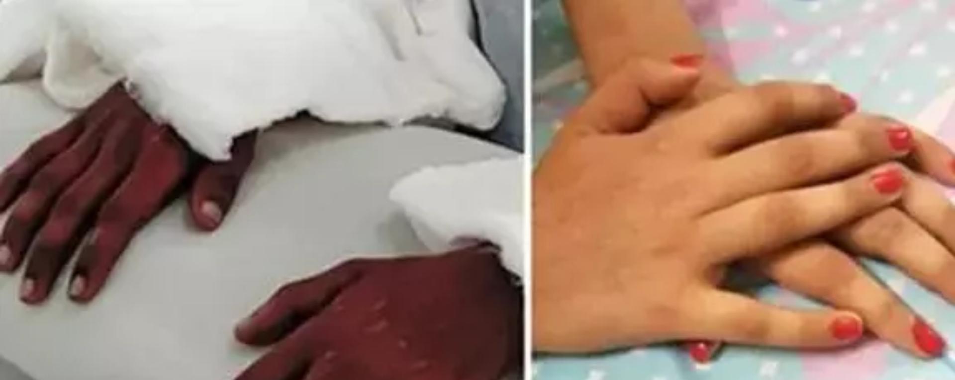 15个荒诞实事：印度征收“乳房税”，阴道里长了“一颗牙”