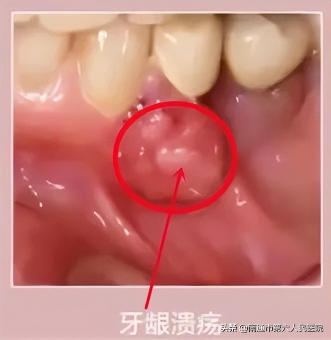 口、颜面部肿瘤，“一束光”带来了新希望