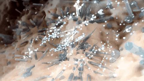 痛风尿酸高吃什么药不伤肾,尿酸高了是先伤肾还是先痛风