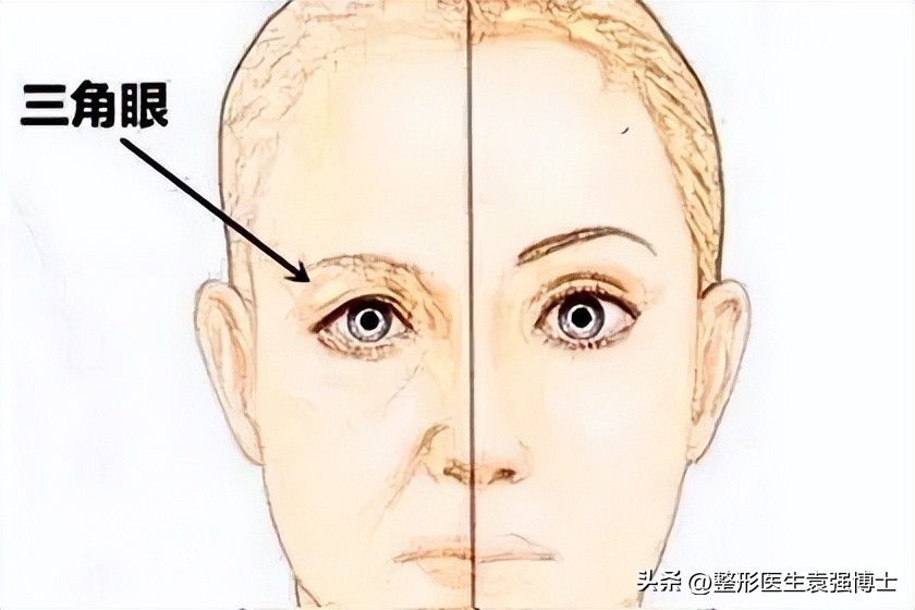 少年上眼皮松弛下垂的解决方法,年纪大眼皮下垂有什么好办法