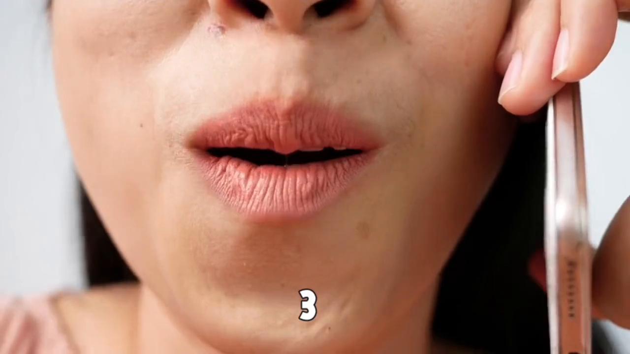 教你一招解决嘴唇干裂脱皮,嘴唇干裂脱皮怎么办有妙招