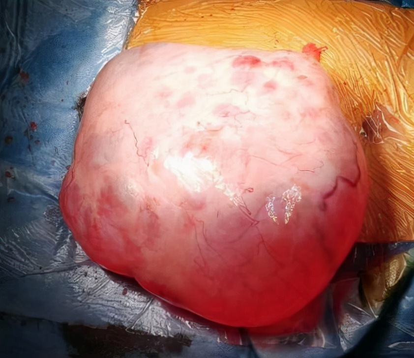 在我拉开衣链的一瞬间,整个肚*弹子**出,把医生吓了一跳