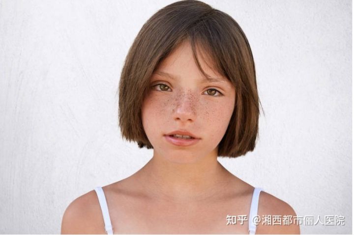 小女孩脸上长雀斑怎么回事？吉首俪人告诉您