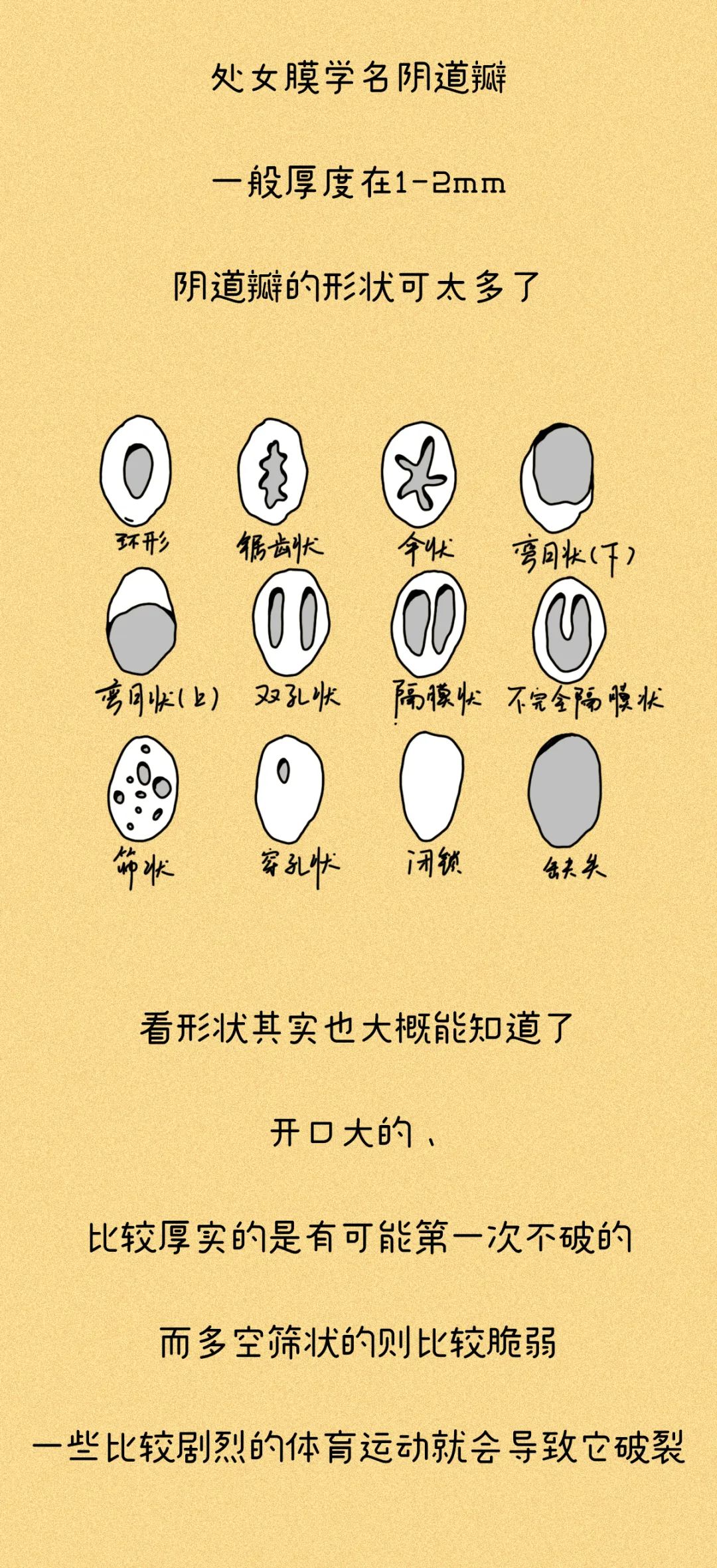 处女膜，到底长什么样