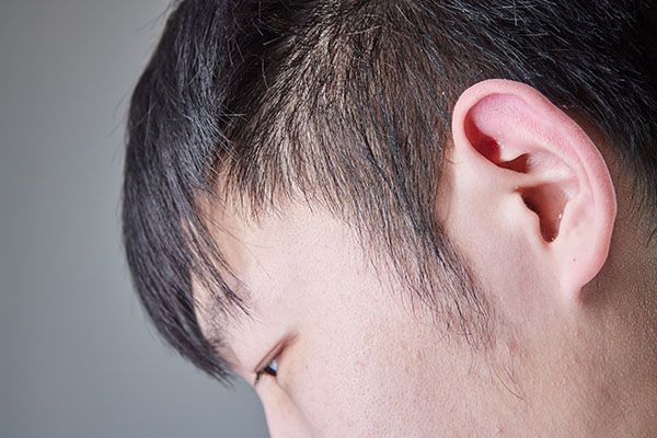 怎么解决头发出油的问题,怎样解决头发出油的问题