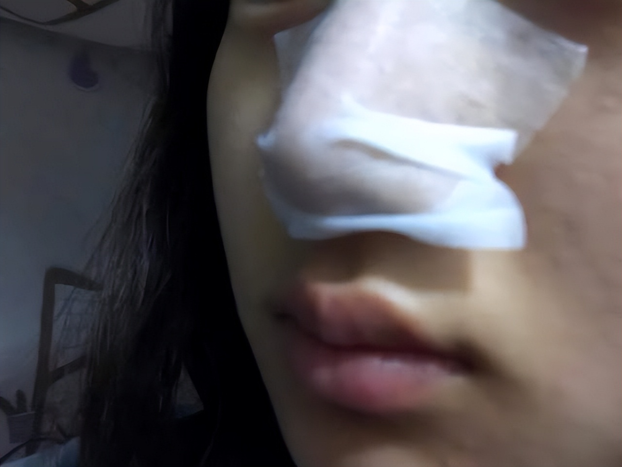 额头眉心发红有闭口粉刺,眉心鼻头频繁起粉刺怎么办