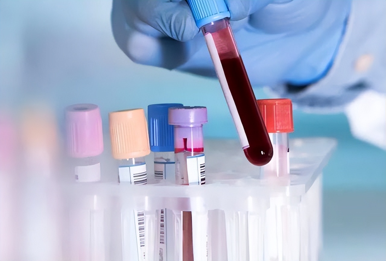 为什么痛风患者应坚决戒烟,为什么痛风这么可怕