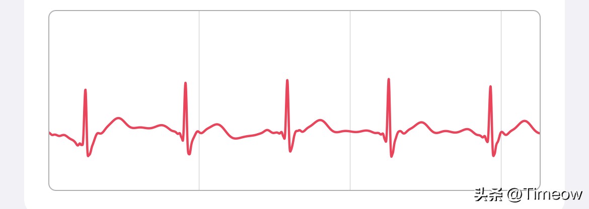 applewatch选购指南s7,applewatchseries7蜂窝版