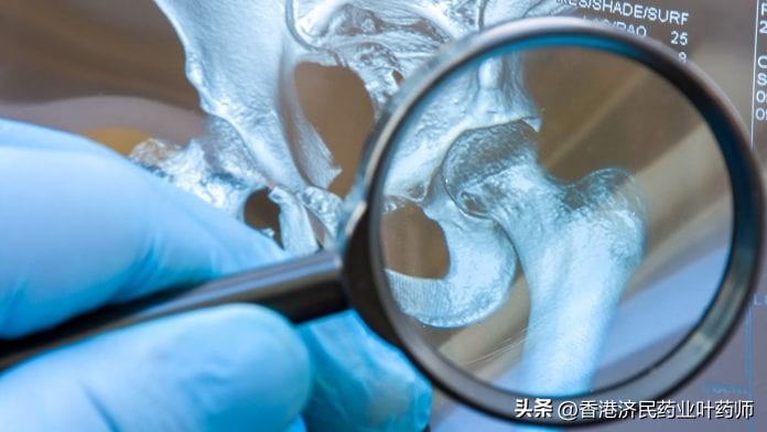 骨质疏松症为什么需要抑制骨吸收,使骨折风险性增加的药物