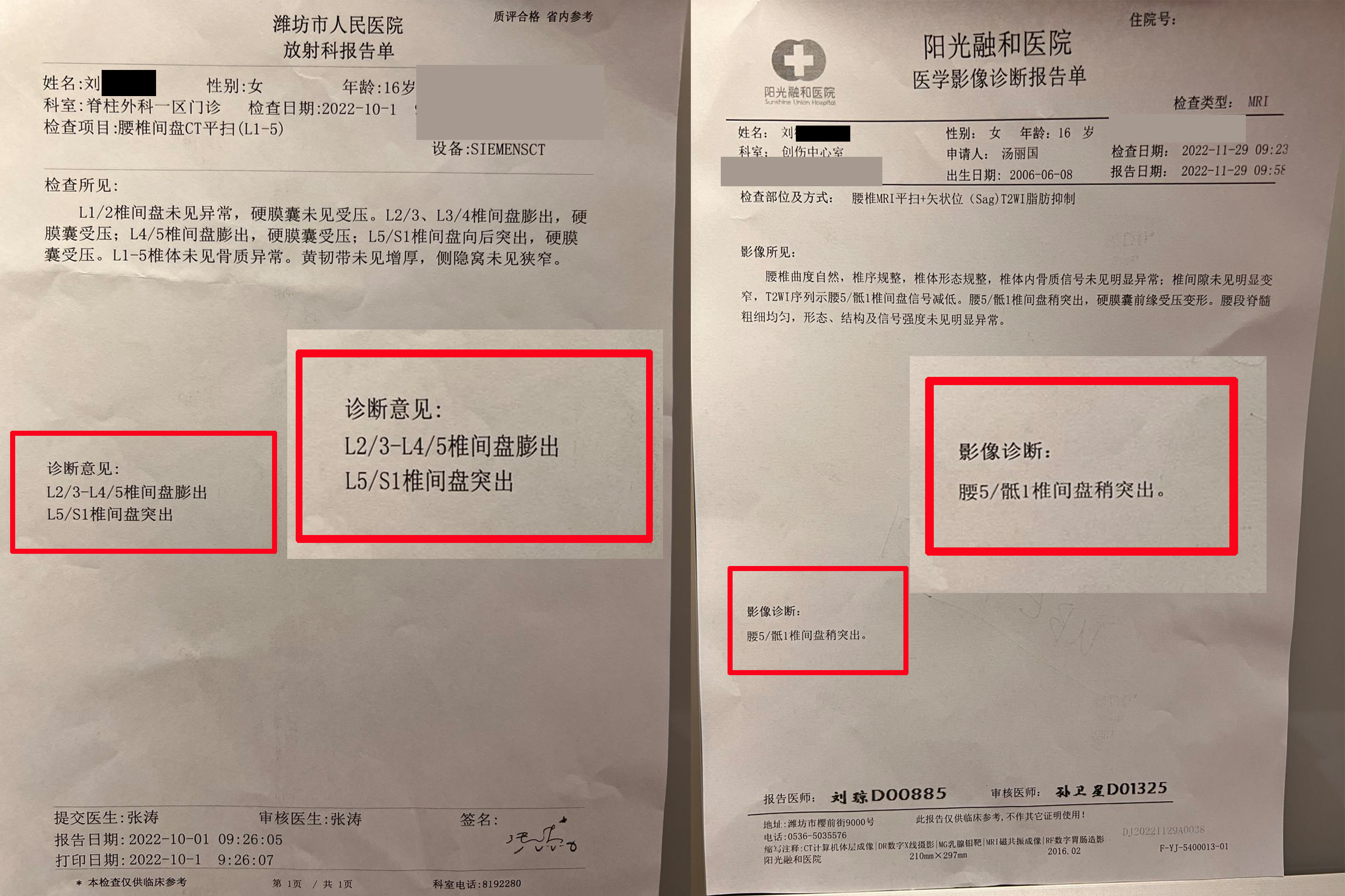 【案例分享】16岁腰椎滑脱患者的康复案例