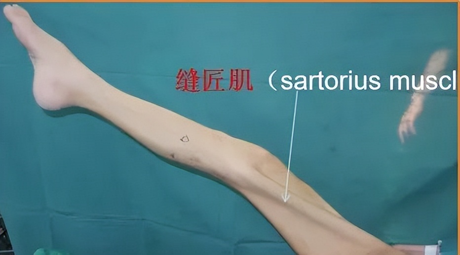 腰骶丛神经为何会受损,骶丛神经损伤