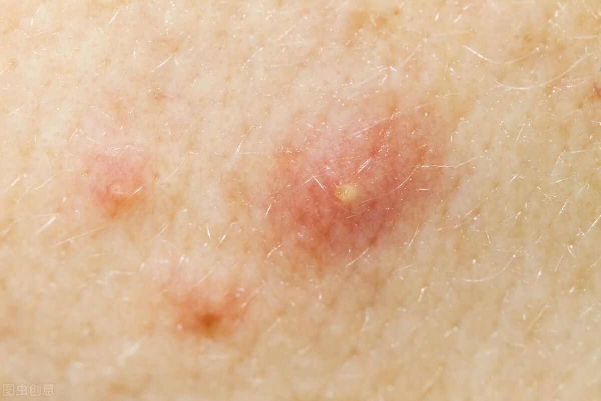 医院不愿开的13种中成药,医院不常开的十二种药好用不贵