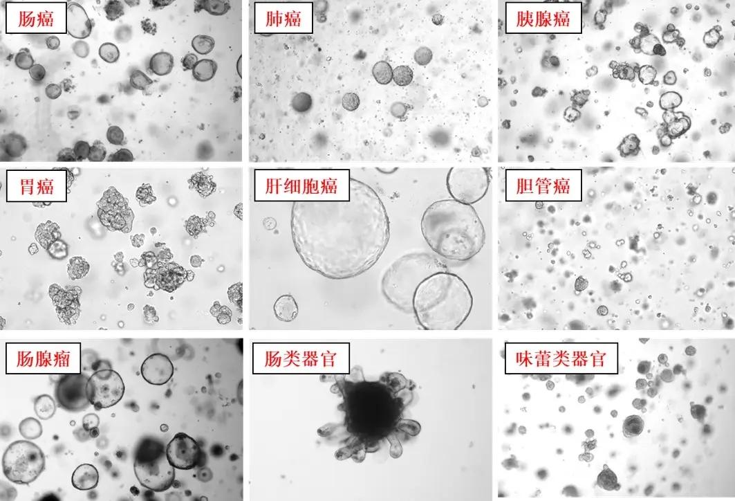 【胖熊医生谈肿瘤防治】重庆大学附属肿瘤医院开了家“生物银行”，可实现肿瘤患者治疗方案“私人定制”？
