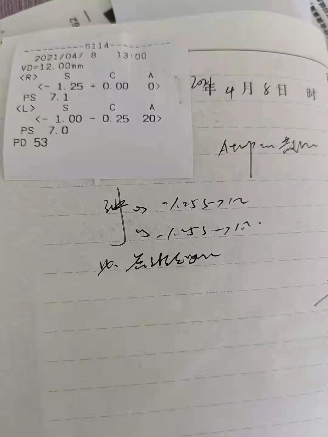 6岁小孩近视只有0.3怎么办,孩子近视了不要着急看医生