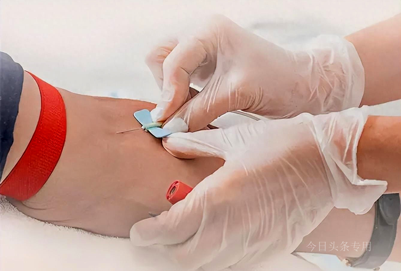 三甲医院治不了的病怎么办,三甲医院治不好的病被村医治好了