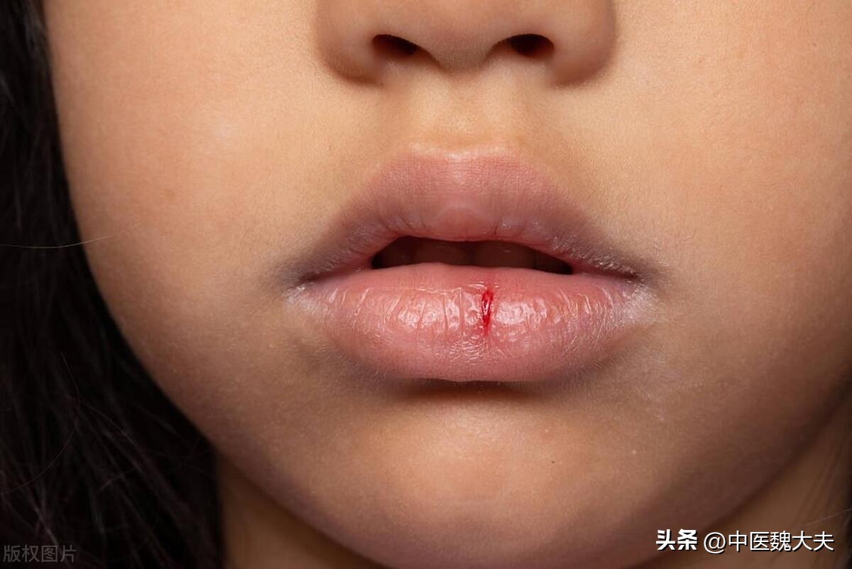 缺维生素b6会引起皮肤过敏吗,皮肤不好吃维生素b6还是吃b2