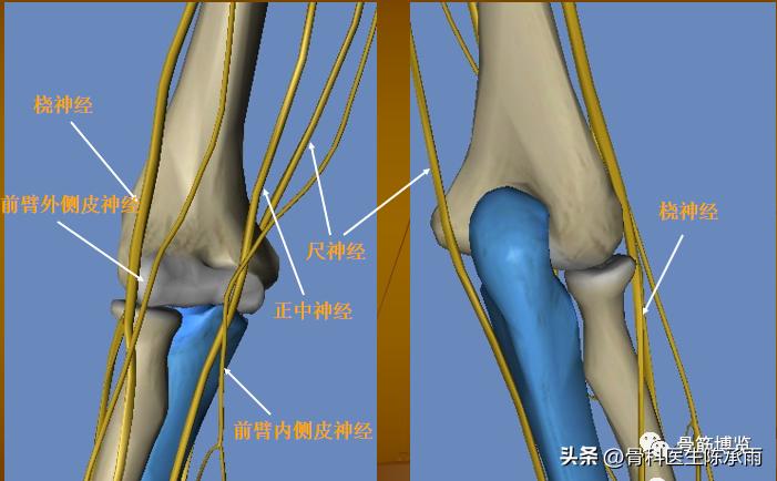 肘关节恐怖三联征最新治疗方法,肘关节恐怖三联征最佳治疗方法