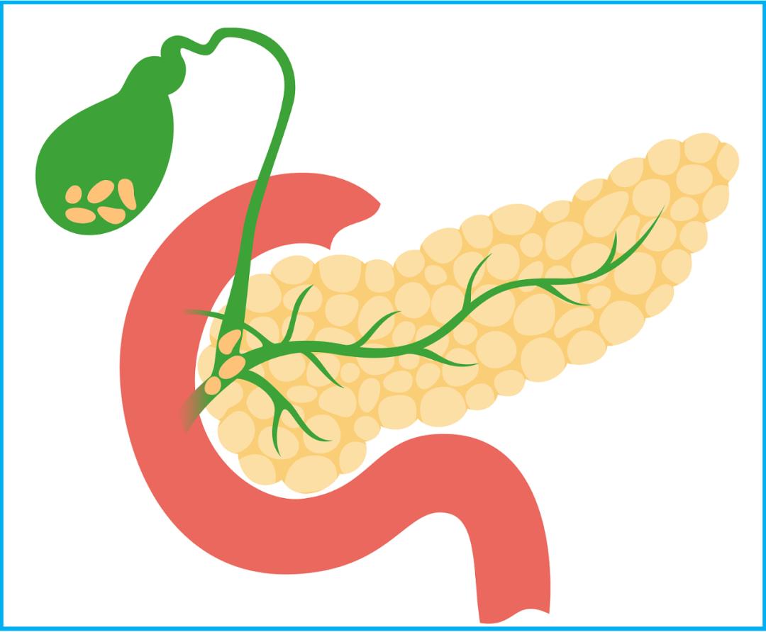 医学科普胰腺炎饮食,胰腺炎科普知识