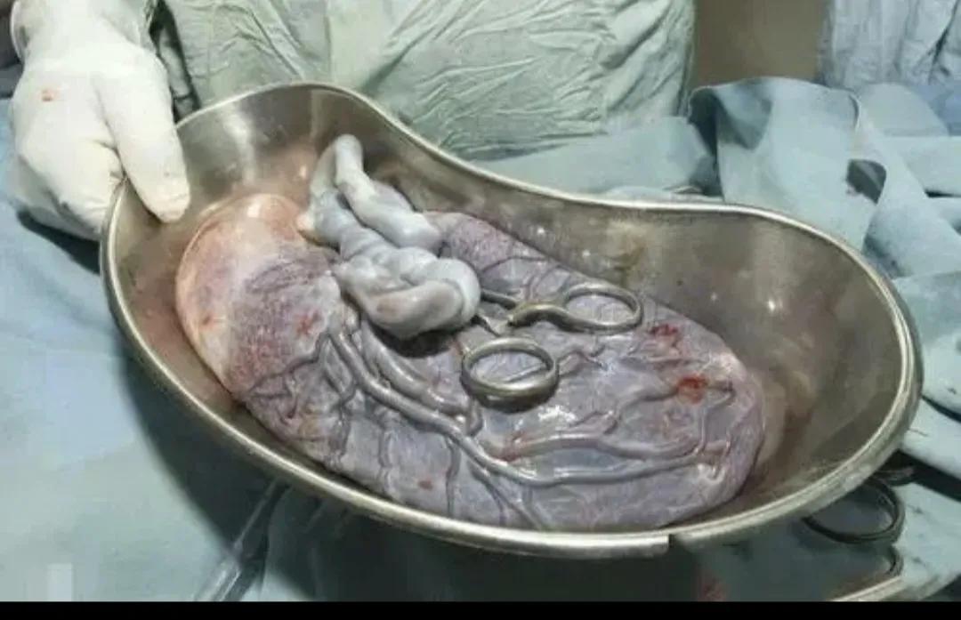 胎盘对人吃了有益吗,人体胎盘能吃吗有什么作用