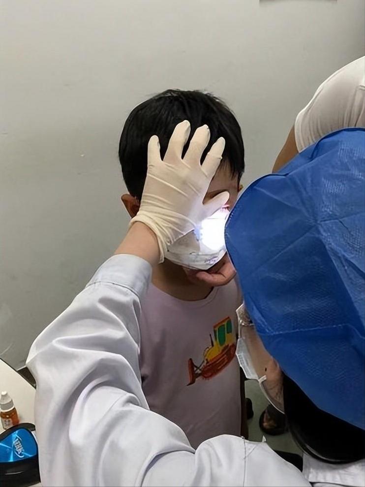 7岁男孩眼球被炸后融化,七岁男童眼睛秒被溶化