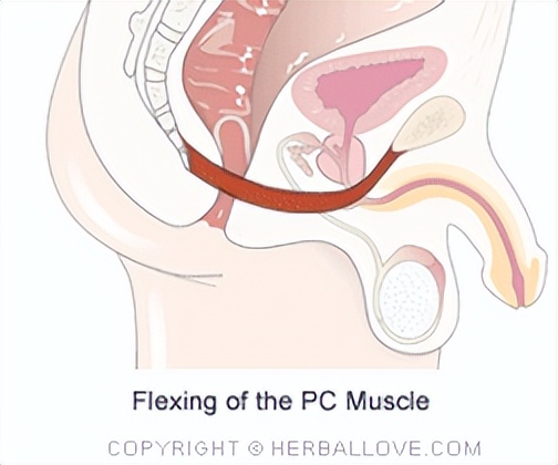 阴部神经电针刺激联合盆底肌锻炼治疗前列腺癌术后尿*禁失**